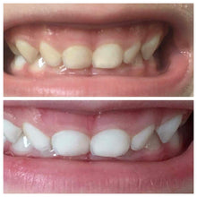 Load image into Gallery viewer, Whitening Toothpaste by Nuskin Available With Fluoride Or Fluoride Free | DIBS BRIGHT Fluoride or Fluoride Free
